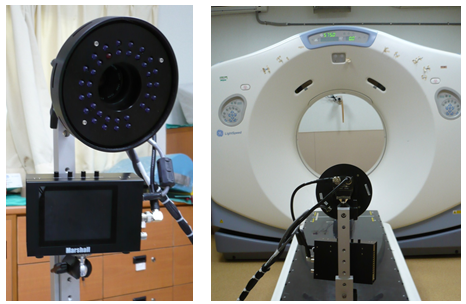 Respiratory Gating Radiation Therapy